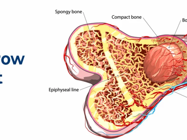 Bone Marrow Disorders and Fatigue: How to Manage Your Energy Levels