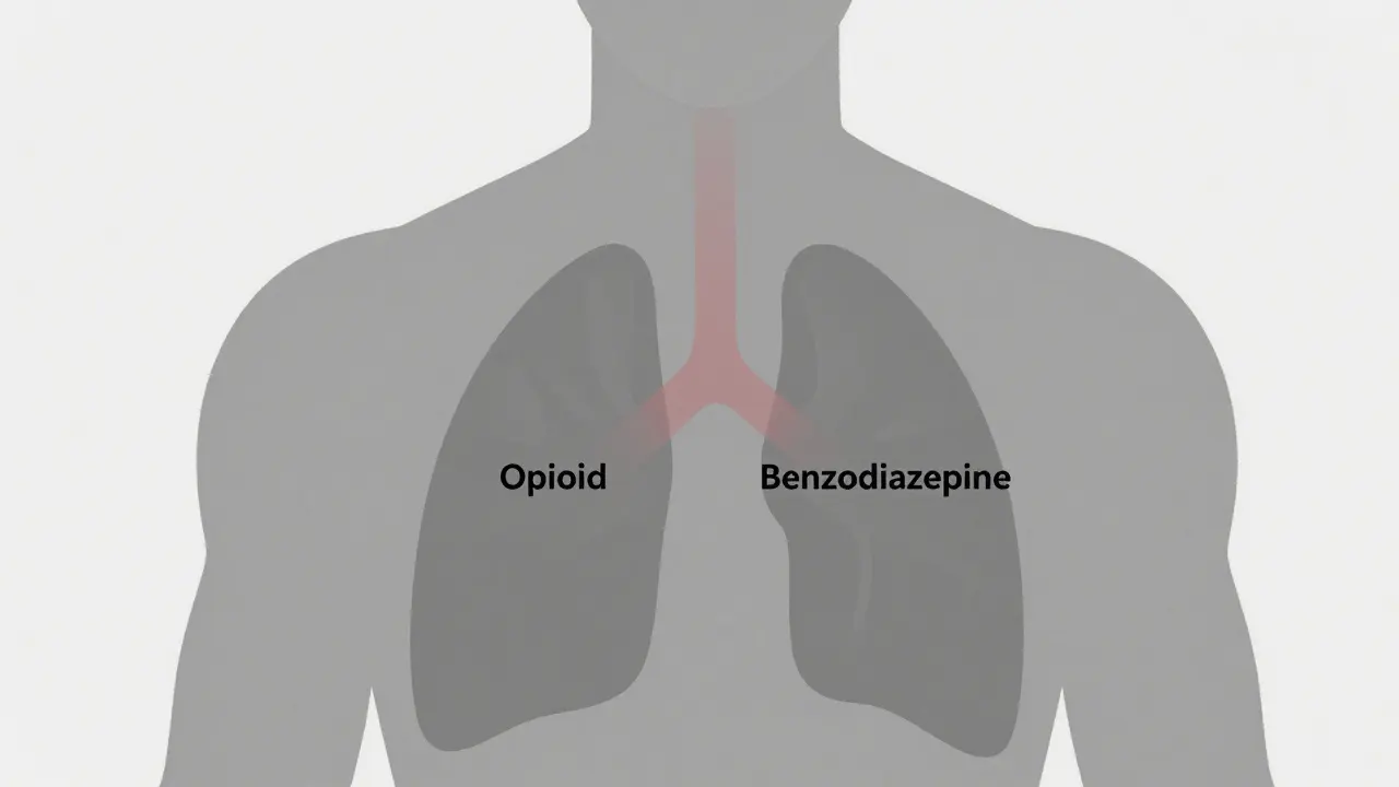 Opioids and Benzodiazepines: How Their Interaction Can Stop Your Breathing